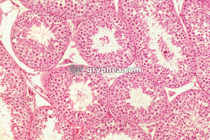 CT Testicule normal x40 - gryphea.com